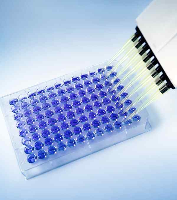 https://diversegenomics.in/wp-content/uploads/2020/04/service_7.jpg